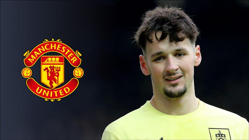 Burnley goalkeeper James Trafford, Man Utd badge
