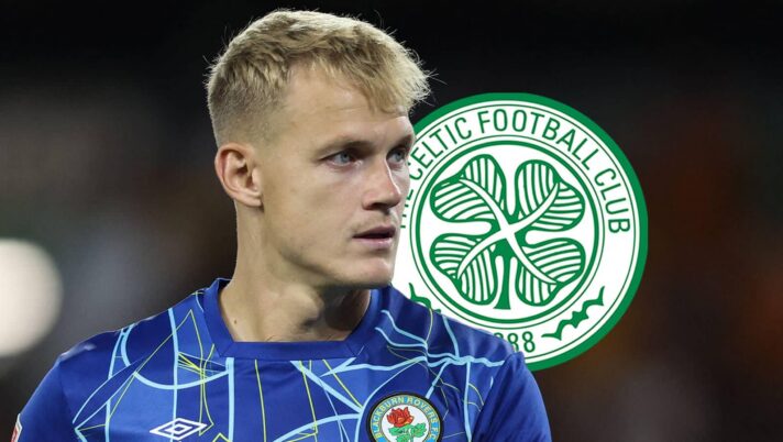 Blackburn Rovers star Balazs Toth with a Celtic badge